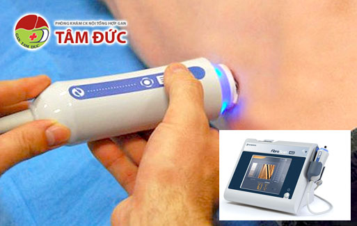 may fibroscan tam soat xo gan gan nhiem mo