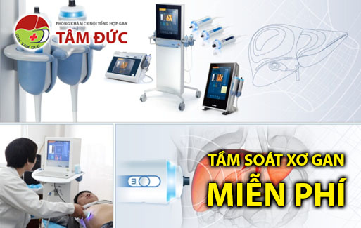 Tầm soát xơ gan Miễn phí bằng công nghệ tầm soát xơ gan Fibroscan 1 tam soat mien phi xo gan fibroscan phong kham gan tam duc