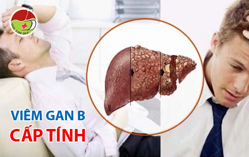 Viêm gan b cấp tính là gì ? Viêm gan B cấp tính có nguy hiểm không ? 1 viem gan B cap tinh - viem gan b cap tinh co nguy hiem khong - Phong kham gan Tam Duc