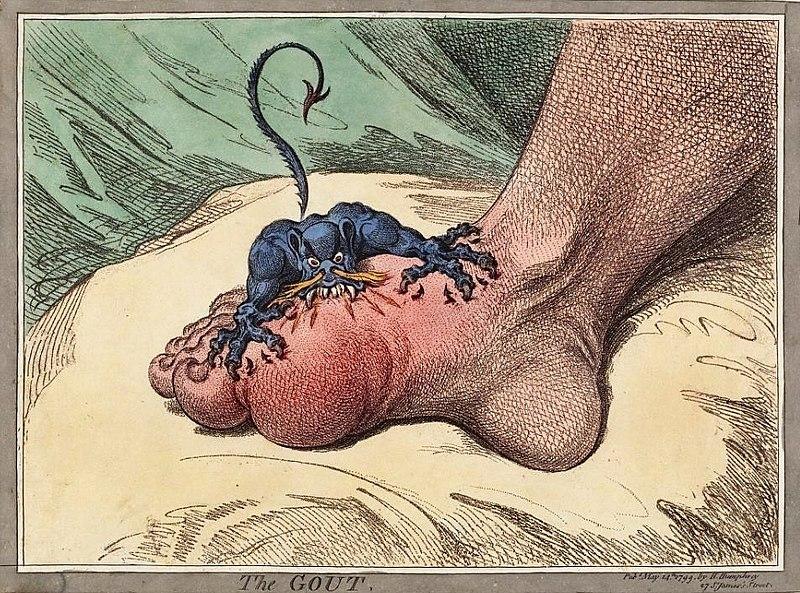 gout