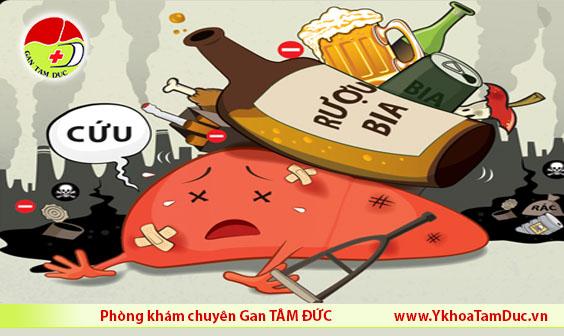 viêm gan do rượu