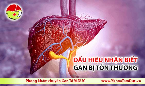 Những dấu hiệu nhận biết gan đang bị tổn thương