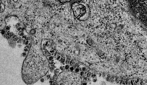 vacxin corona vaccine corona