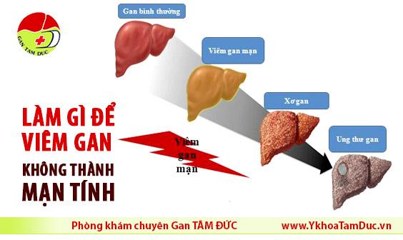 lam gi de viem gan khong thanh man tinh