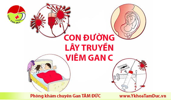 cac con duong lay truyen viem gan c viem gan sieu vi c