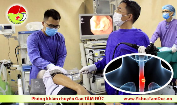 noi soi phat hien ung thu thanh quan