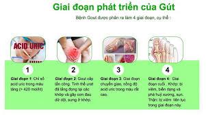 Benh Gut co may giai doan HA
