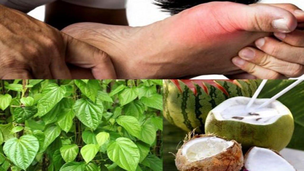Chữa bệnh gút bằng quả dừa 8 Chua benh gut bang qua dua trau