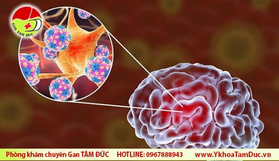 SARS-CoV-2 virus brain damage virus covid19 tan cong nao