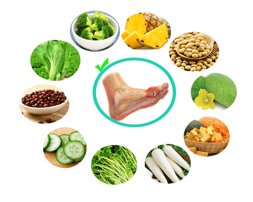 Bệnh Gút ăn củ cải trắng được không ? 4 Benh gut an cu cai trang duoc khong