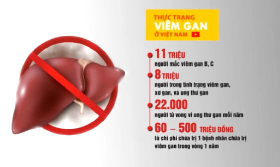 viem-gan-b-viem-gan-c-tinh-trang-ung-thu-gan-tai-viet-nam