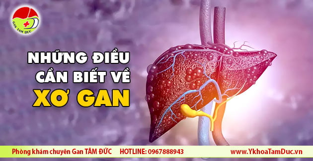 nhung dieu can biet ve xo gan