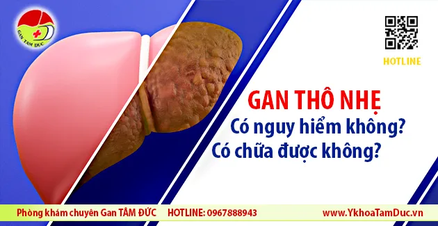 Gan thô nhẹ có sao không? Có chữa được không? 1 gan tho nhe co sao khong co chua duoc khong