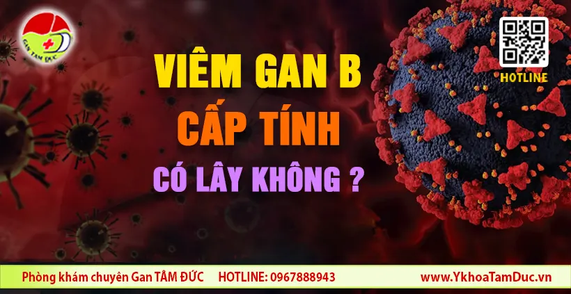 Viêm gan B cấp tính có lây không? 1 Viêm gan B cấp tính có lây không