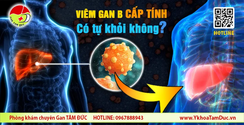 Viêm gan B cấp tính có tự khỏi không? Chuyên gia giải đáp 1 viêm gan B cấp tính có tự khỏi không