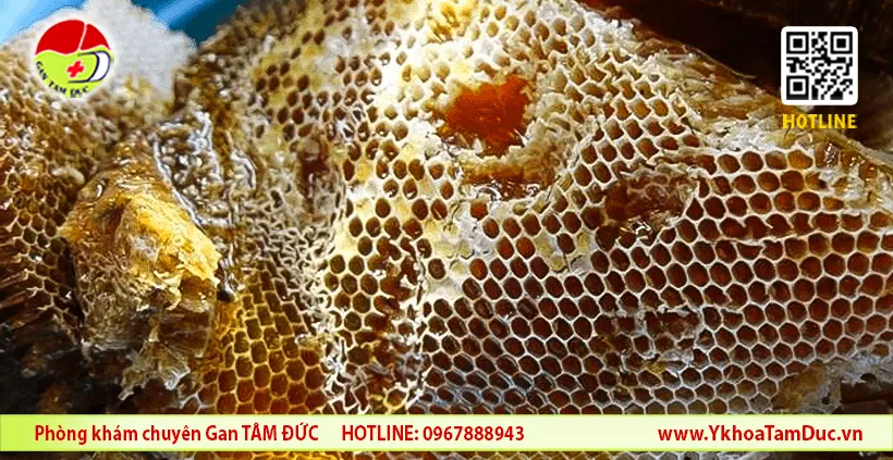 Gan nhiễm mỡ có uống được mật ong không? 1 Mật ong nguyên chất