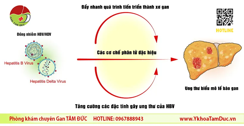 Đồng nhiễm Viêm gan B và D: Nhận Diện, Rủi Ro và Hướng Điều Trị 3 Quá trình từ đồng nhiễm HBV/HDV đến ung thư biểu mô tế bào gan. Sự kết hợp của hai virus này làm tăng tốc độ xơ gan và nguy cơ ung thư.