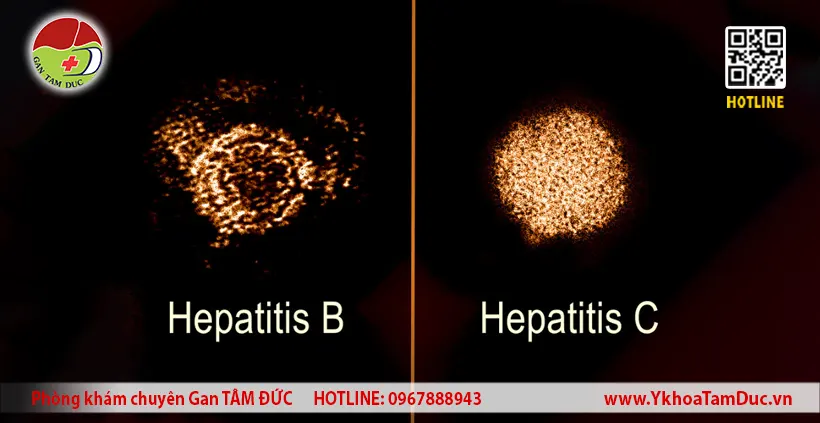 Đồng nhiễm Viêm Gan B và C: Chiến Lược Điều Trị Chuyên Sâu 1 Hình ảnh virus Viêm gan B và Viêm gan C kính hiển vi