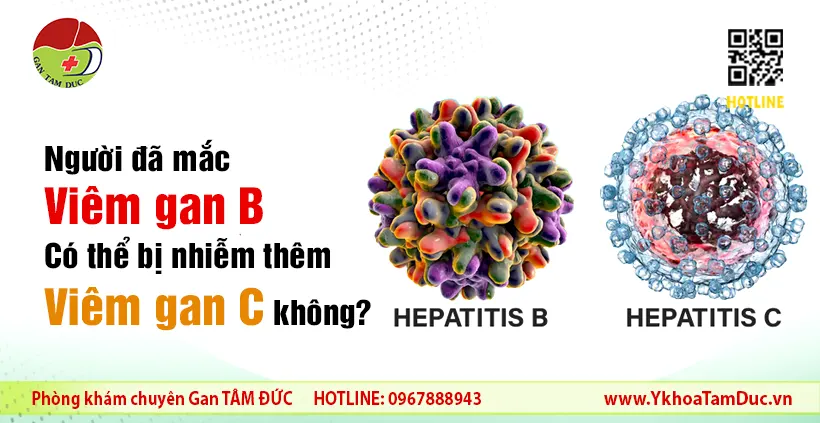 Người đã mắc viêm gan B có thể bị nhiễm thêm viêm gan C không? 1 Người đã mắc viêm gan B có thể bị nhiễm thêm viêm gan C không?