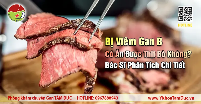 Hình ảnh thịt bò thái lát minh họa cho bài viết phân tích người bị viêm gan B có ăn được thịt bò không.