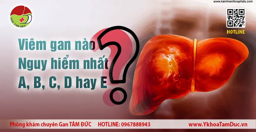 Minh họa so sánh mức độ nguy hiểm các loại viêm gan A B C D E - Phòng khám Gan Tâm Đức.
