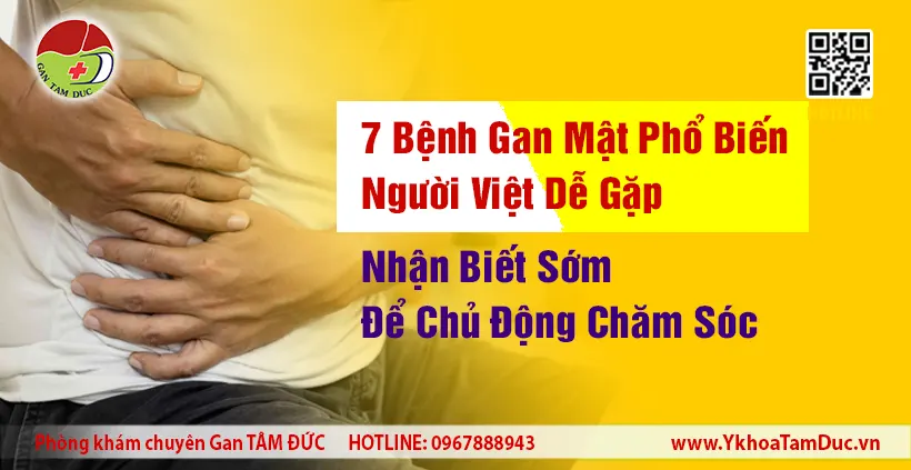7 Bệnh Gan Mật Phổ Biến Người Việt Dễ Gặp: Nhận Biết Sớm Để Chủ Động Chăm Sóc 5 7 bệnh gan mật phổ biến ở người Việt và dấu hiệu nhận biết sớm