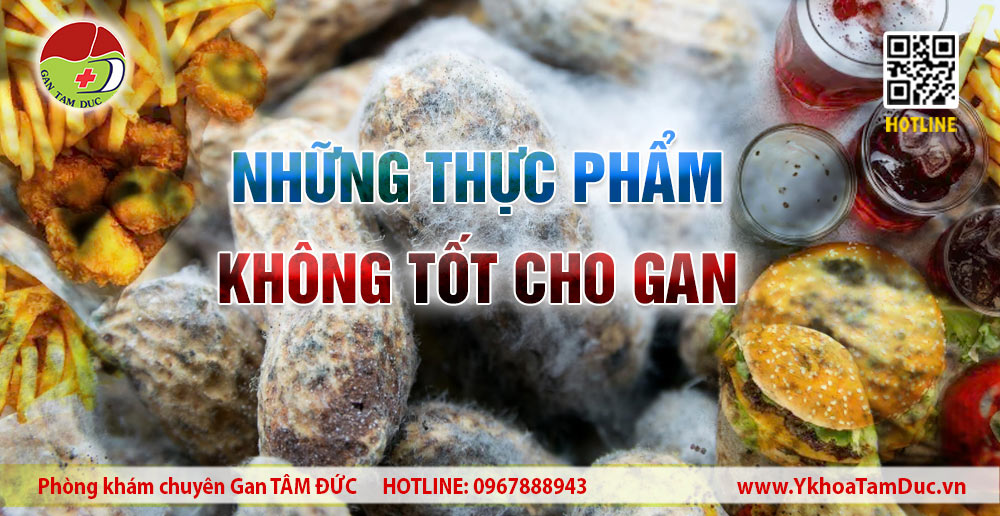 Những thực phẩm không tốt cho gan như đồ chiên rán, thực phẩm mốc và rượu bia