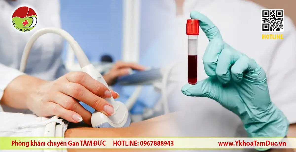 Gan nhiễm mỡ xét nghiệm hay siêu âm? Giải đáp chuẩn y khoa 1 Bác sĩ thực hiện siêu âm gan và cầm ống máu xét nghiệm