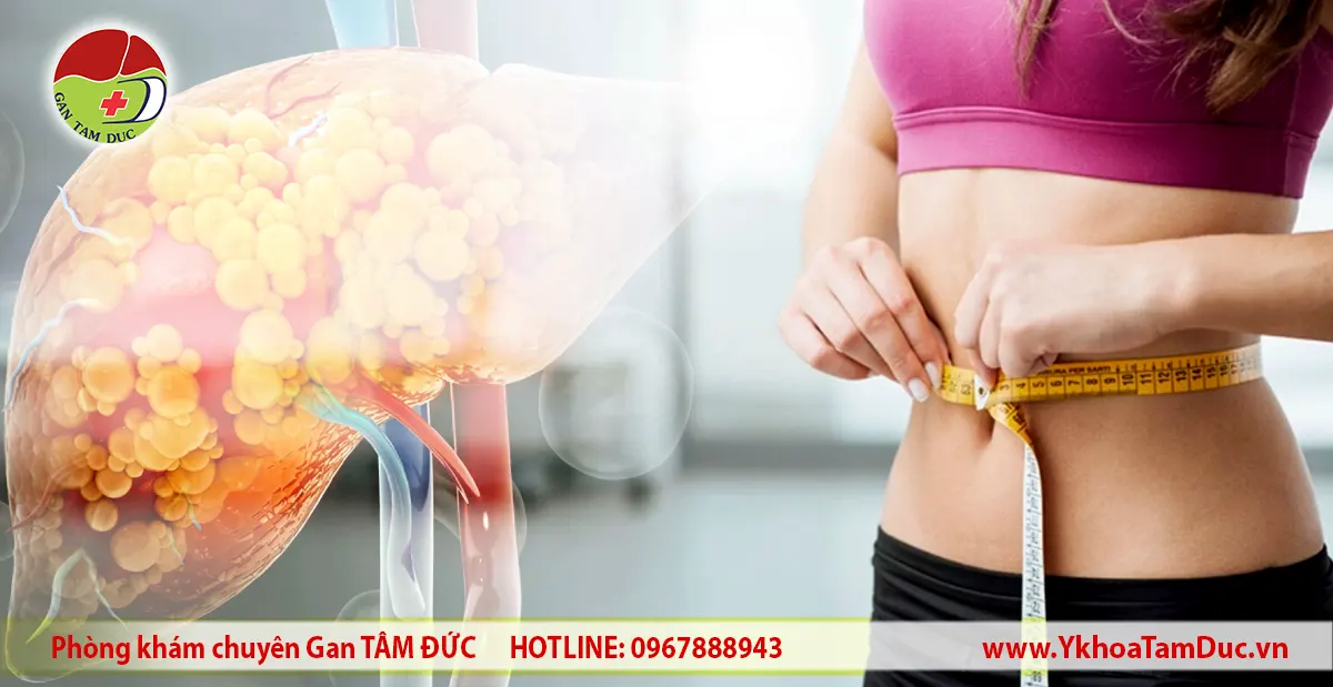 Minh họa gan nhiễm mỡ ở người có vóc dáng gầy và vòng eo nhỏ
