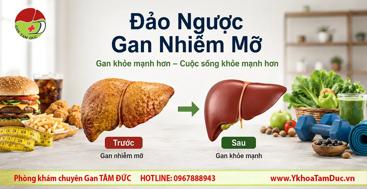 Minh họa sự cải thiện gan nhiễm mỡ liên quan rối loạn chuyển hóa (MASLD) thông qua giảm cân, chế độ ăn lành mạnh và tập luyện đều đặn; hình ảnh so sánh gan trước và sau mang tính giáo dục, không dùng để chẩn đoán.