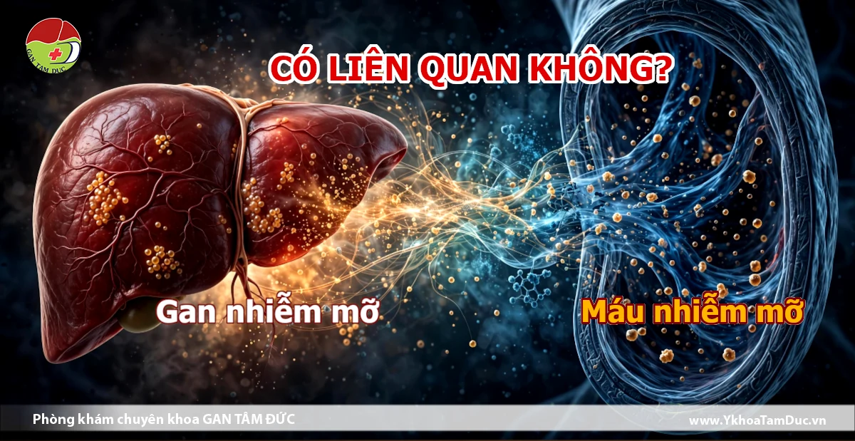 Gan nhiễm mỡ và máu nhiễm mỡ: Có liên quan không? 1 Minh họa mối liên hệ giữa gan nhiễm mỡ và rối loạn lipid máu trong bối cảnh rối loạn chuyển hóa
