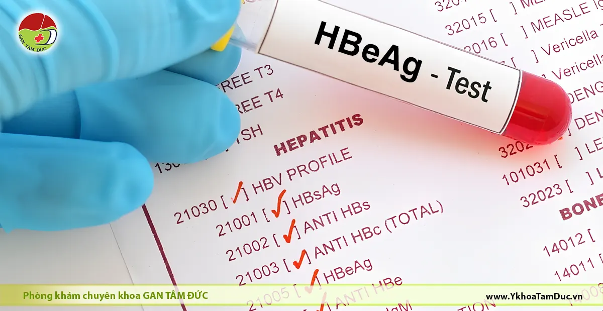 HBeAg Âm Tính Có Cần Điều Trị Không? 1 Ống mẫu xét nghiệm HBeAg trong hồ sơ xét nghiệm viêm gan B