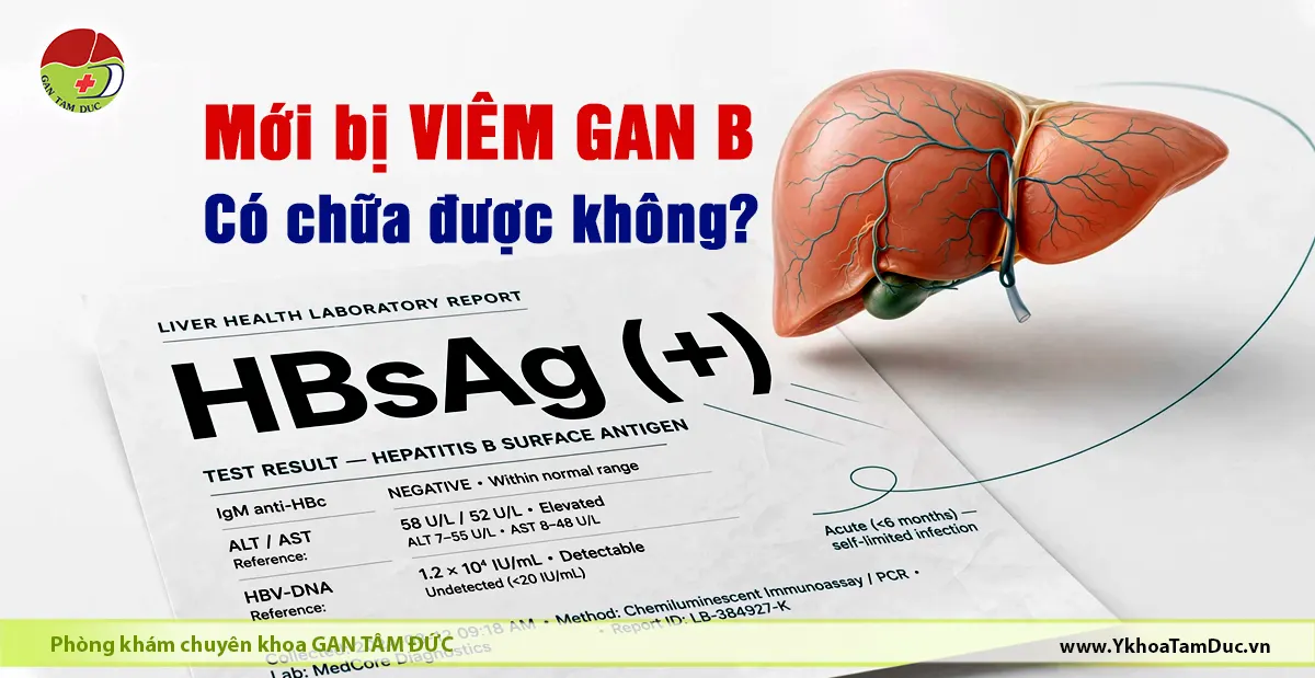 Mới bị viêm gan B có chữa được không? 1 Minh họa gan kèm báo cáo xét nghiệm máu HBsAg dương tính giải thích viêm gan B mới mắc, tham chiếu chỉ số ALT AST HBV-DNA và dấu hiệu nhiễm cấp