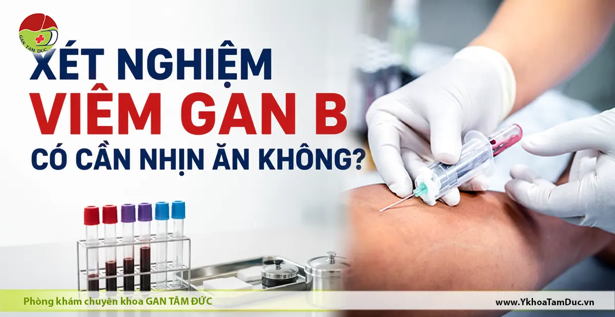 Xét Nghiệm Viêm Gan B Có Cần Nhịn Ăn Không? 1 Bác sĩ thực hiện lấy máu xét nghiệm viêm gan B cho bệnh nhân tại Phòng khám Gan Tâm Đức