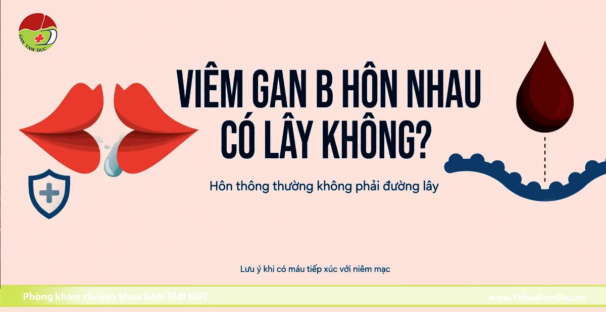 Minh họa viêm gan B và hành vi hôn nhau, cho thấy hôn thông thường không phải đường lây HBV và cần lưu ý khi có máu tiếp xúc với niêm mạc