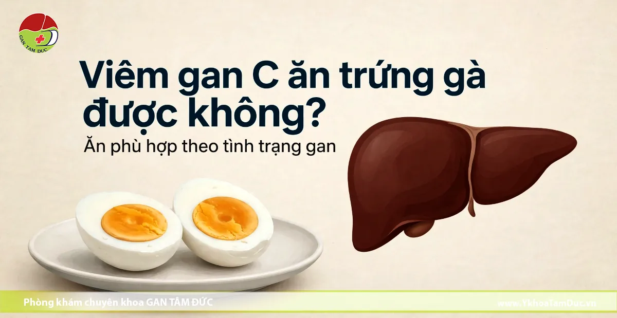 Viêm Gan C Ăn Trứng Gà Được Không? 2 Đồ họa giáo dục về dinh dưỡng cho người viêm gan C, gồm hình vẽ giải phẫu gan người và đĩa trứng gà luộc cắt đôi.