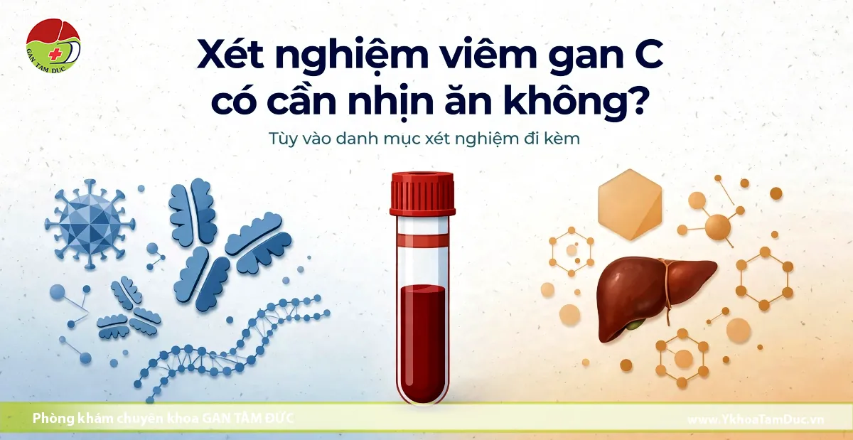 Xét nghiệm viêm gan C có cần nhịn ăn không? 1 Infographic hướng dẫn chuẩn bị trước khi xét nghiệm máu viêm gan C, minh họa ống nghiệm, virus HCV, kháng thể và lá gan kèm văn bản giải thích điều kiện nhịn ăn tùy thuộc vào danh mục xét nghiệm đi kèm.