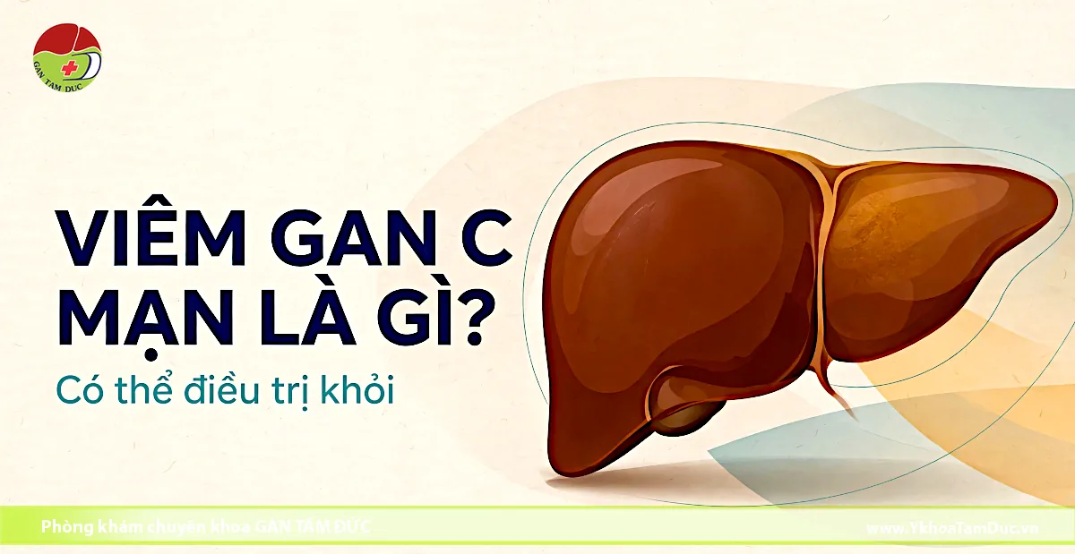 HÌnh ảnh minh họa giải phẫu lá gan người kèm dòng chữ Viêm gan C mạn là gì và thông tin từ Phòng khám chuyên khoa Gan Tâm Đức